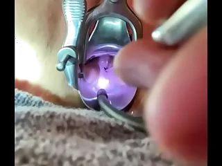 Bakes rosebud suddenly penetrates laic os painfully after gentle match pressure