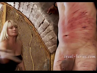 Painful Red Bruises on Poor Guy's Lend substance